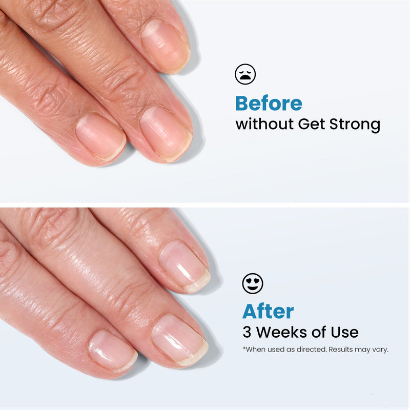 Get Strong Nail Hardener by LONDONTOWN